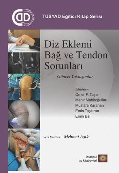 Diz Eklemi Bağ ve Tendon Sorunları