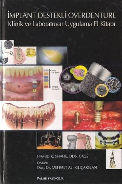 İmplant Destekli Overdenture